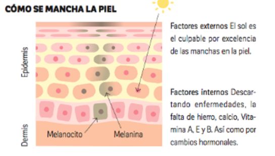 Combate esas molestas manchas de la cara Combate esas molestas manchas de la cara