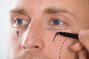 Cirugías estéticas para hombres Cirugías estéticas para hombres