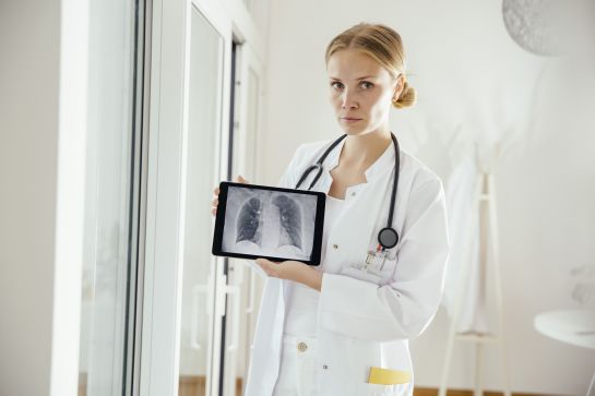 10 consideraciones del cáncer de pulmón 10 consideraciones del cáncer de pulmón