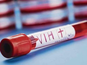 ¿Está cerca la cura contra el VIH? ¿Está cerca la cura contra el VIH?