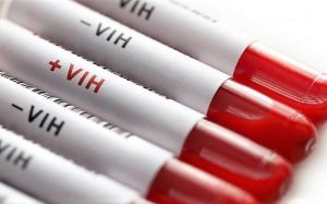 Todo sobre el VIH Todo sobre el VIH