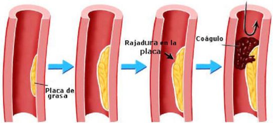 ¿Qué onda con los coágulos? ¿Qué onda con los coágulos?
