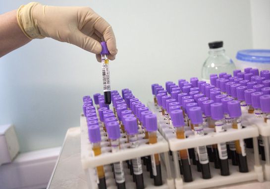 SOPITAS: La CDMX se prepara para crear un Banco de ADN SOPITAS: La CDMX se prepara para crear un Banco de ADN