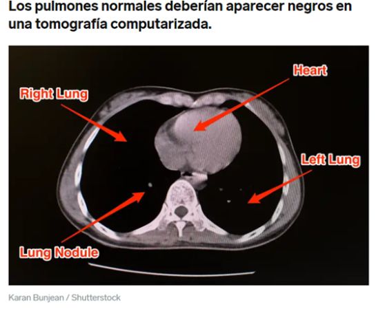 ¿Qué hace el coronavirus con nuestro cuerpo? ¿Qué hace el coronavirus con nuestro cuerpo?