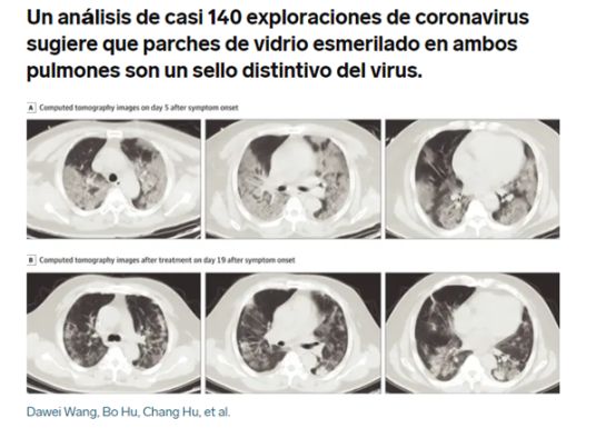 ¿Qué hace el coronavirus con nuestro cuerpo? ¿Qué hace el coronavirus con nuestro cuerpo?