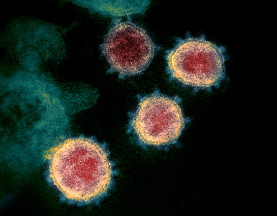 En México 95 mil personas han perdido la vida por el nuevo coronavirus, de acuerdo con los registros oficiales, pero este número podría ser incluso 3 veces mayor En México 95 mil personas han perdido la vida por el nuevo coronavirus, de acuerdo con los registros oficiales, pero este número podría ser incluso 3 veces mayor