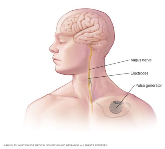 El nervio vago es el nervio más largo del cuerpo humano y tiene muchísimas ramas que van desde el tronco encefálico hasta la parte más baja de los intestinos. El nervio vago es el nervio más largo del cuerpo humano y tiene muchísimas ramas que van desde el tronco encefálico hasta la parte más baja de los intestinos.