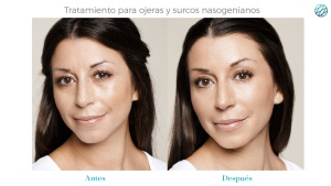 Rostro joven y sin bisturí Rostro joven y sin bisturí