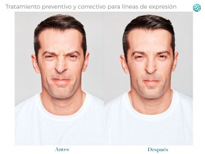 Rostro joven y sin bisturí Rostro joven y sin bisturí