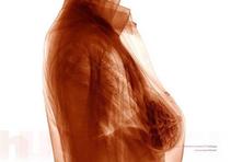 Estos rayos X cambiarán tu forma de ver el cuerpo y el mundo