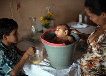 La ONU exige respetar el derecho al aborto ante brote de zika
