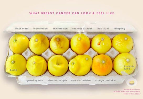 Esta imagen de limones ayuda a detectar el cáncer de mama Esta imagen de limones ayuda a detectar el cáncer de mama