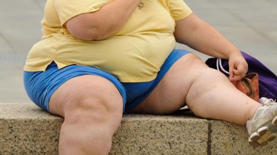 La obesidad puede causar 11 tipos de cáncer La obesidad puede causar 11 tipos de cáncer