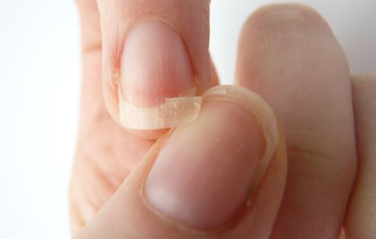 Las uñas revelan trastornos de salud Las uñas revelan trastornos de salud