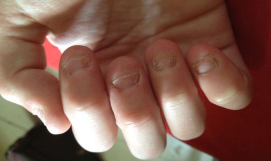 Las uñas revelan trastornos de salud Las uñas revelan trastornos de salud