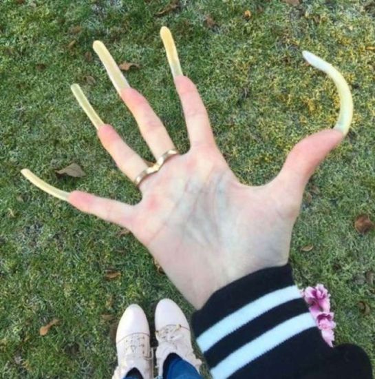 Esta obsesión ha hecho que así luzcan sus uñas Esta obsesión ha hecho que así luzcan sus uñas