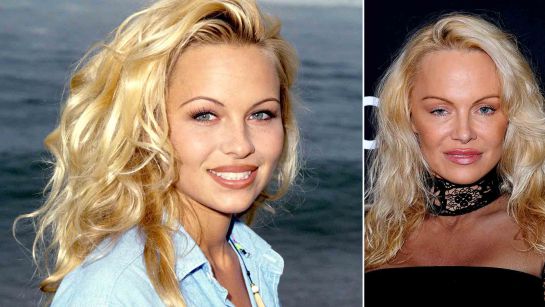 Pamela Anderson y su sorprendente transformación Pamela Anderson y su sorprendente transformación