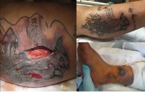 Hombre recién tatuado muere después de nadar en el Golfo de México Hombre recién tatuado muere después de nadar en el Golfo de México