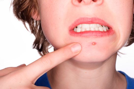 7 hábitos que los dermatólogos quieren que dejes de hacer lo más antes posible 7 hábitos que los dermatólogos quieren que dejes de hacer lo más antes posible