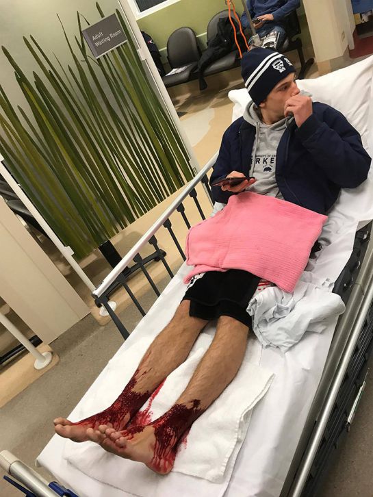 Piojos marinos atacan los pies de un joven australiano Piojos marinos atacan los pies de un joven australiano