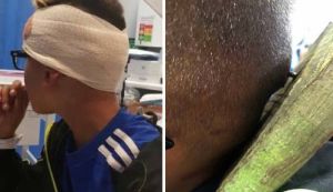 Niños le clavan un trozo de madera a compañero con autismo Niños le clavan un trozo de madera a compañero con autismo
