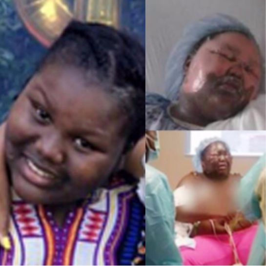 “Hot water challenge”: el nuevo reto peligroso en las redes sociales