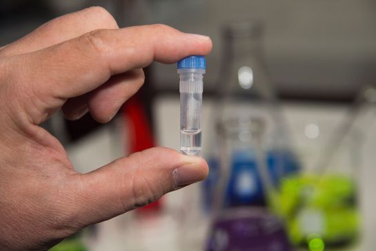 Microplásticos también en el agua de grifo Microplásticos también en el agua de grifo