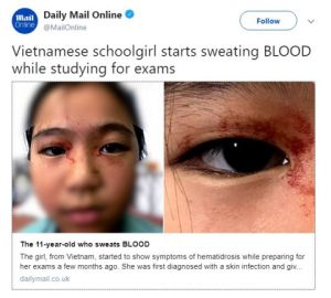 Niña suda sangre por estrés escolar Niña suda sangre por estrés escolar