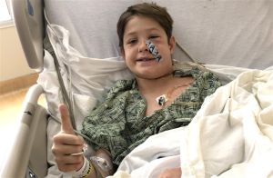 Sobrevive niño después de que varilla atraviesa su cara Sobrevive niño después de que varilla atraviesa su cara