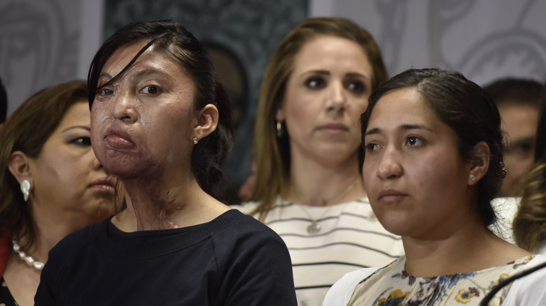 Proponen hasta 20 años de cárcel a quien ataque a mujeres con ácido