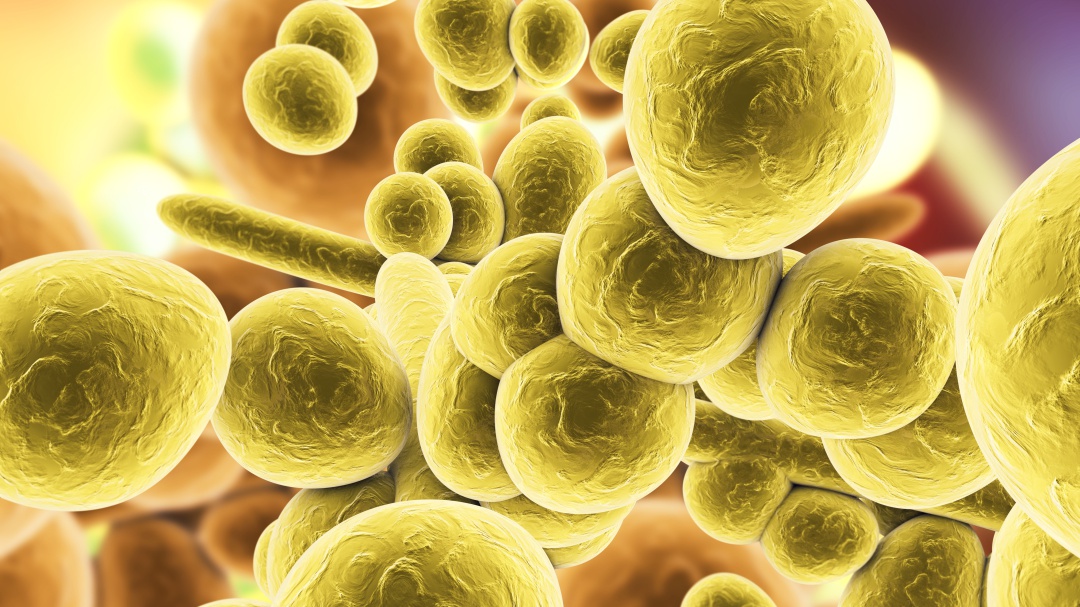 Peligrosa infección se propaga por el mundo y enciende las alarmas
