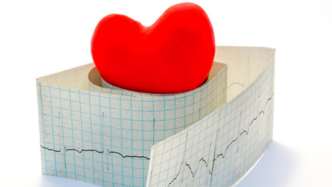 Taquicardia: Cuando el corazón se acelera