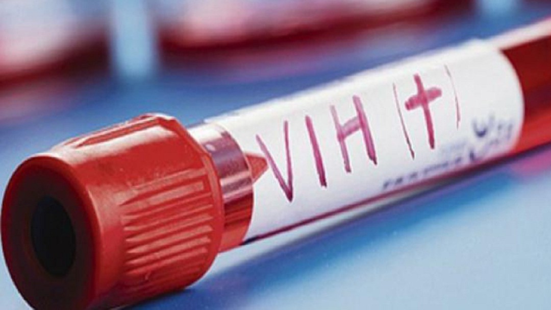 Urge Congreso incrementar medidas de prevención y control del VIH-SIDA