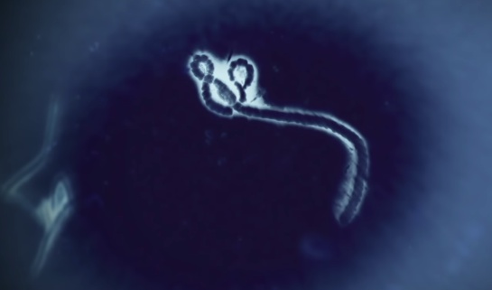 El ébola es un virus para el cual no existe cura El ébola es un virus para el cual no existe cura