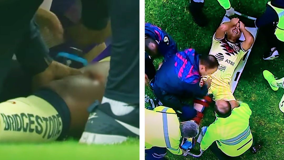 Giovani dos Santos sufre brutal lesión en el Clásico América contra Chivas