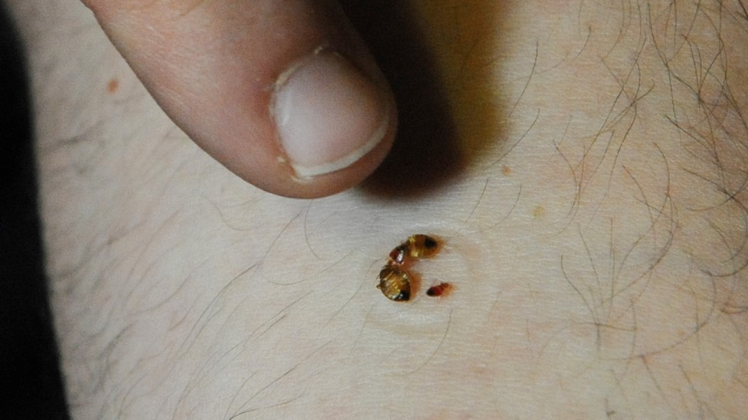 Chagas, más de un millón de personas lo padecen en México