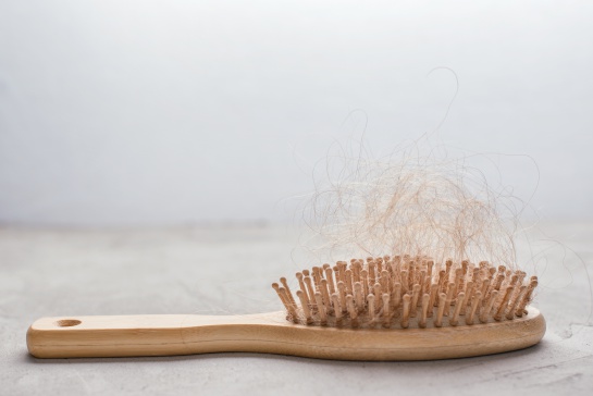 Esto se atribuye al daño en los folículos que podría causar el estrés, además provoca que el cabello entre en la fase catágena Esto se atribuye al daño en los folículos que podría causar el estrés, además provoca que el cabello entre en la fase catágena
