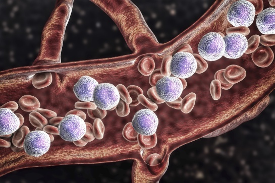 La leucemia linfoblástica aguda, es el cáncer más frecuente en los niños a nivel mundial, pero la Ciudad de México tiene los índices más altos de casos La leucemia linfoblástica aguda, es el cáncer más frecuente en los niños a nivel mundial, pero la Ciudad de México tiene los índices más altos de casos