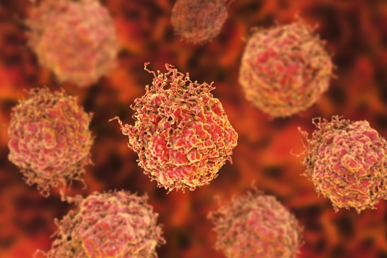 Aquellos pacientes que tengan cáncer de mama, pulmón, vejiga, gástrico o intestinal serán los primeros en poder recibir este tratamiento Aquellos pacientes que tengan cáncer de mama, pulmón, vejiga, gástrico o intestinal serán los primeros en poder recibir este tratamiento
