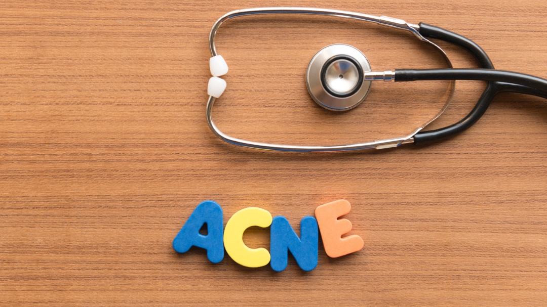 ¿Cómo eliminar las cicatrices de acné?