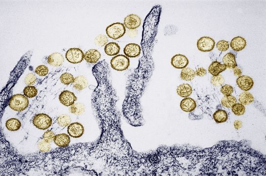hantavirus-nuevo-virus-china-coronavirus hantavirus-nuevo-virus-china-coronavirus