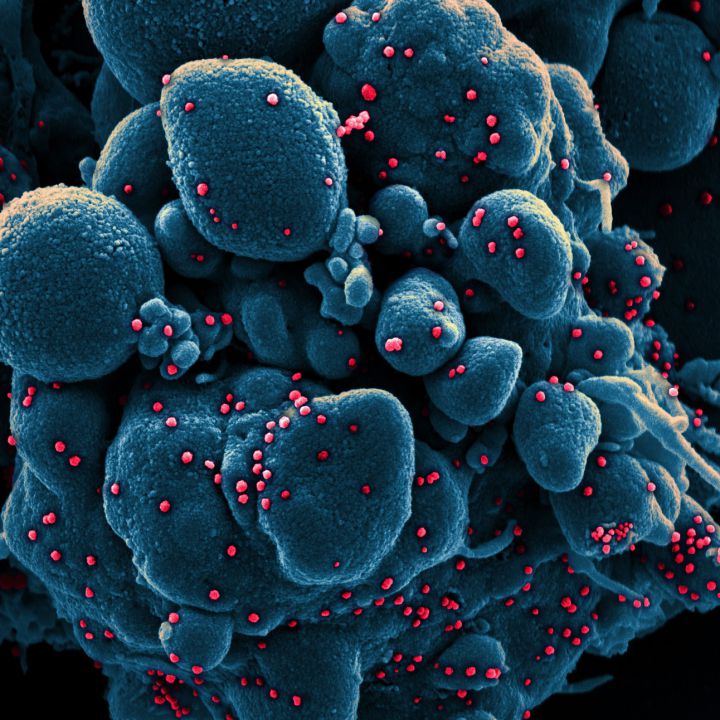 Captan al nuevo coronavirus dañando las células humanas