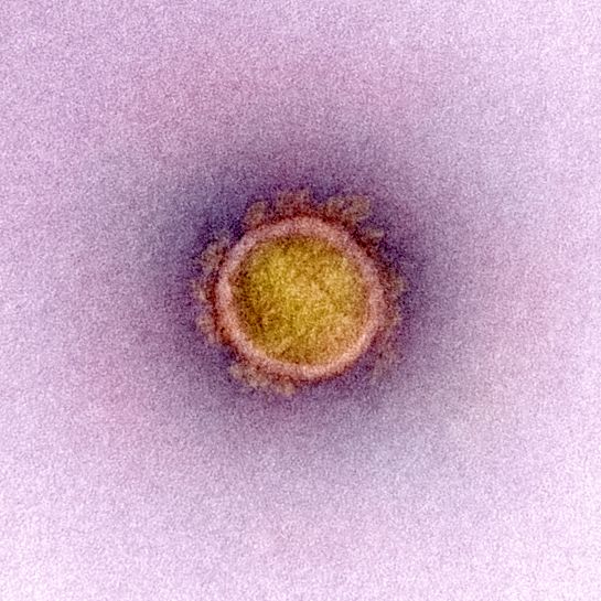 El Instituto Nacional de Alergias y Enfermedades Infecciosas de Estados Unidos (NIAID, por sus siglas en inglés) difundió una nueva serie de imágenes del virus SARS-CoV-2 El Instituto Nacional de Alergias y Enfermedades Infecciosas de Estados Unidos (NIAID, por sus siglas en inglés) difundió una nueva serie de imágenes del virus SARS-CoV-2