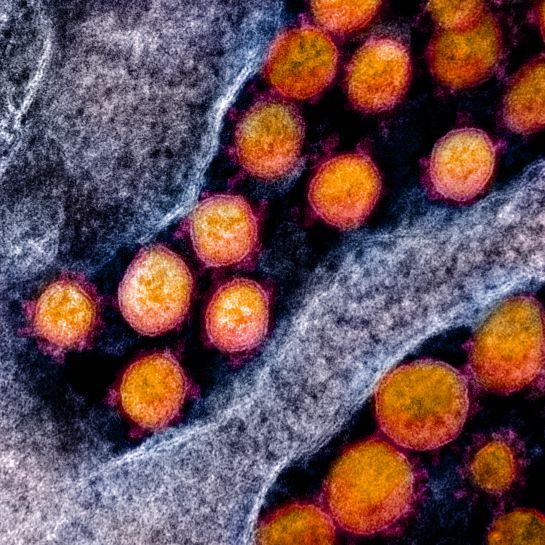 Instituto Nacional de Alergias y Enfermedades Infecciosas de Estados Unidos (NIAID, por sus siglas en inglés) difundió, a través de la plataforma Flickr, una nueva serie de imágenes del virus SARS-CoV-2, el patógeno responsable de la infección del covid-19. Instituto Nacional de Alergias y Enfermedades Infecciosas de Estados Unidos (NIAID, por sus siglas en inglés) difundió, a través de la plataforma Flickr, una nueva serie de imágenes del virus SARS-CoV-2, el patógeno responsable de la infección del covid-19.