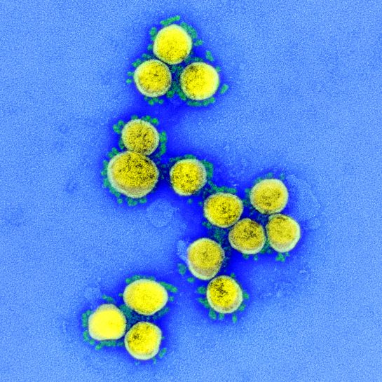 Instituto Nacional de Alergias y Enfermedades Infecciosas de Estados Unidos (NIAID, por sus siglas en inglés) difundió, a través de la plataforma Flickr, una nueva serie de imágenes del virus SARS-CoV-2, el patógeno responsable de la infección del covid-19. Instituto Nacional de Alergias y Enfermedades Infecciosas de Estados Unidos (NIAID, por sus siglas en inglés) difundió, a través de la plataforma Flickr, una nueva serie de imágenes del virus SARS-CoV-2, el patógeno responsable de la infección del covid-19.