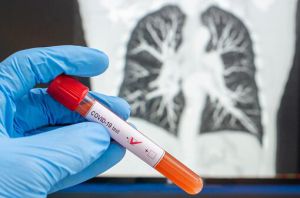 Remdesivir es un medicamento que se desarrolló para combatir el Ébola Remdesivir es un medicamento que se desarrolló para combatir el Ébola