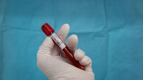China ha aprobado este lunes el uso interno en el Ejército de la nueva vacuna de coronavirus China ha aprobado este lunes el uso interno en el Ejército de la nueva vacuna de coronavirus