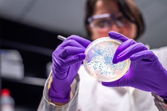 A casi un año, las autoridades chinas reconocieron un brote bacteriano de brucella A casi un año, las autoridades chinas reconocieron un brote bacteriano de brucella