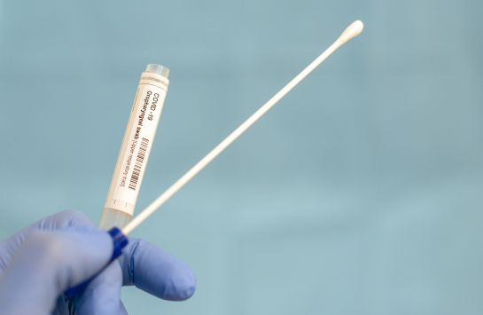 Los tests para aquellos que tienen síntomas son gratuitos Los tests para aquellos que tienen síntomas son gratuitos