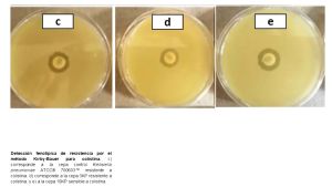 Detectan científicos del IPN bacterias resistentes al antibiótico colistina Detectan científicos del IPN bacterias resistentes al antibiótico colistina